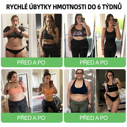 👩‍⚕️Zbývá jen 10 lahví! Omezená nabídka s extra 50% slevou! ✨ Využij šanci na štíhlejší a energičtější život – kdo zmešká, čeká až do příštího roku!