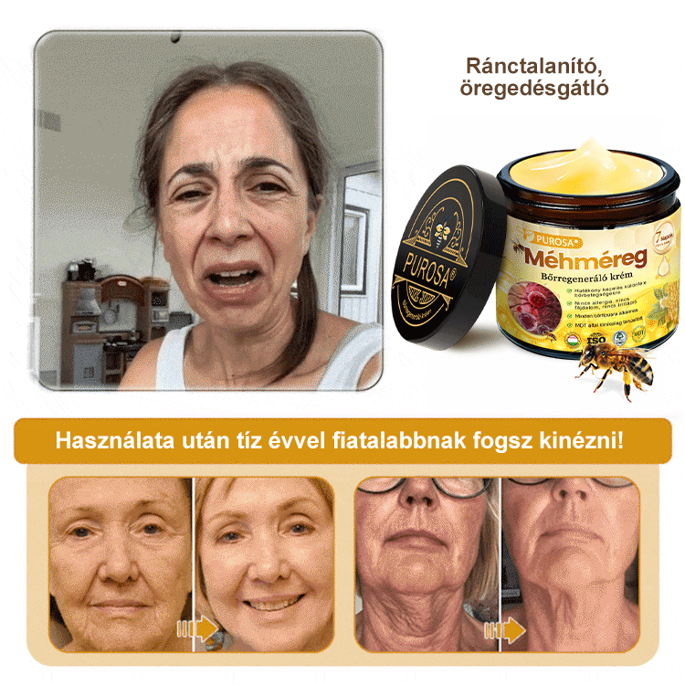 🐝PUROSA® Obnovující krém s včelím jedem｜✅Kompletní řešení pro odolné kožní problémy, jako je stárnutí, ekzém, jizvy a lupénka