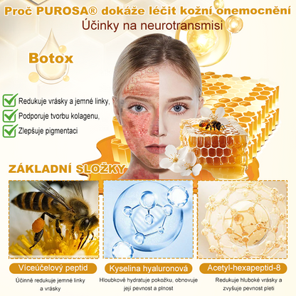 🐝PUROSA® Obnovující krém s včelím jedem｜✅Kompletní řešení pro odolné kožní problémy, jako je stárnutí, ekzém, jizvy a lupénka