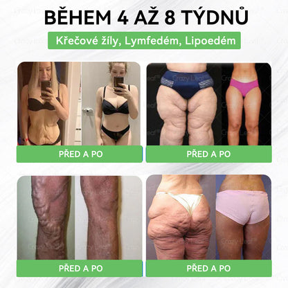 👩‍⚕️Zbývá jen 10 lahví! Omezená nabídka s extra 50% slevou! ✨ Využij šanci na štíhlejší a energičtější život – kdo zmešká, čeká až do příštího roku!