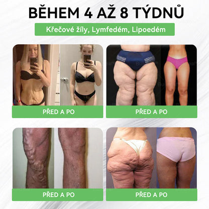 🏆️BuildLeaf®🎁 Jen 10 balení! Využijte jedinečnou 30% slevu hned teď! Nezmeškejte svou šanci—taková nabídka se už do příštího roku neobjeví. Jednejte rychle! 180denní záruka vrácení peněz!