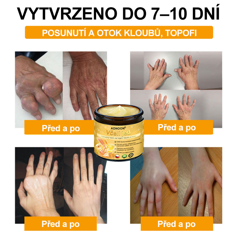 ADNOON®Včelí jed pokročilý krém na hojení kloubů a kostí